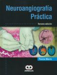 neuroangiografia practica 3 ed