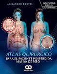 atlas quirurgico para el paciente posperdida masiva de peso