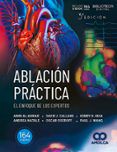 ablacion practica el enfoque de los expertos