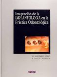 integracion de la implantologia en la practica odontologica