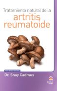 tratamiento natural de la artritis reumatoide