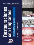 restauraciones con implantes 3 ed 2017